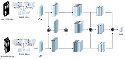 Use of a Sparse-Response Deep Belief Network and Extreme Learning Machine to Discriminate Alzheimer's Disease, Mild Cognitive Impairment, and Normal Controls Based on Amyloid PET/MRI Images